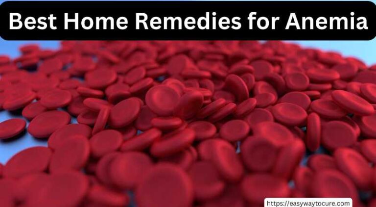 Best Home Remedies For Anemia Easy Way To Cure 5968